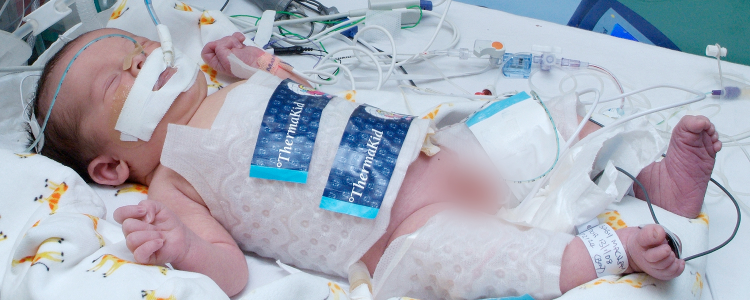 New neonatal cooling education resources for better treatment of babies suffering a lack of oxygen during birth